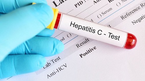 MyHep Lvir – Helps with Hepatitis C