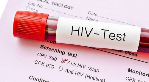 PEP: How to prevent HIV infection after possible exposure