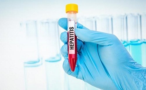 Hepatic Encephalopathy Brain Damage Due to Hepatitis