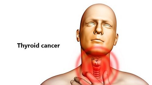 Thyroid Cancer: What is the Thyroid Gland and what are common Cancer Types?