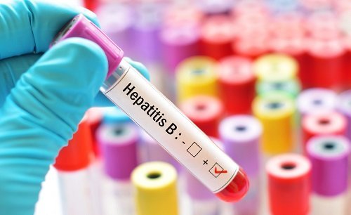 Why Hepatitis B Viral is Worth your Attention?