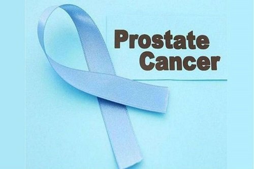 What are treatment types that Oncologists for Prostate Cancer suggest?
