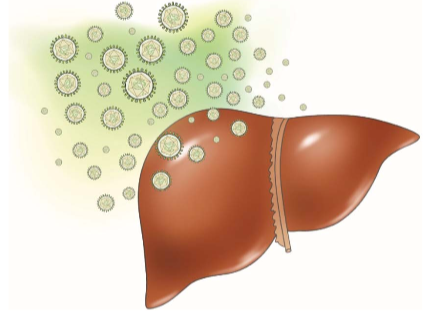 Hepatitis C- Symptoms, Complications, Risk Factors, Transmission and Treatment