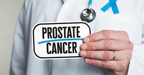 The Most Active Element for treating Metastatic Prostate Cancer in Adult Male Patients