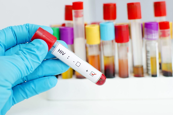 What are the Three Stages or Types of HIV Infection?