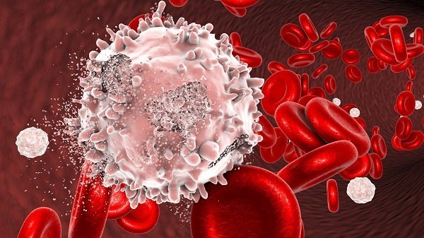Types of Blood Cancers and their Treatment