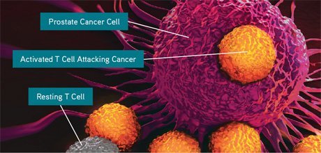 castrate-resistant prostate cancer