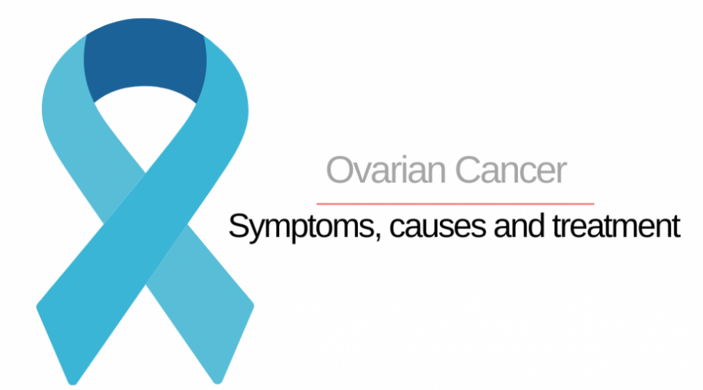 Symptoms and Causes of Ovarian Cancer