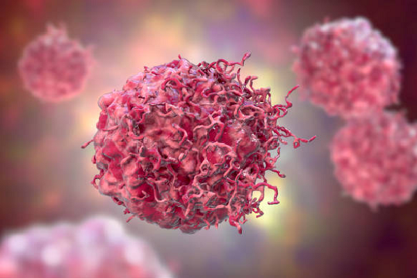 Soft Tissue Sarcoma (sts)