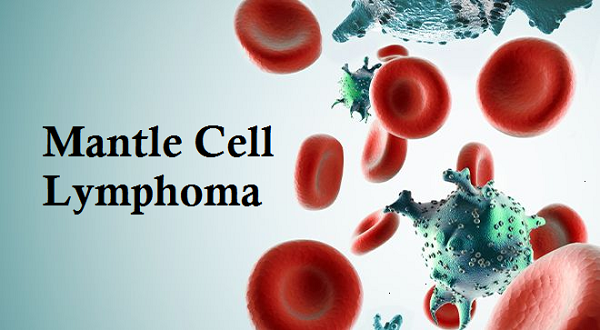 What is the Survival Rate of Mantle-Cell Lymphoma?