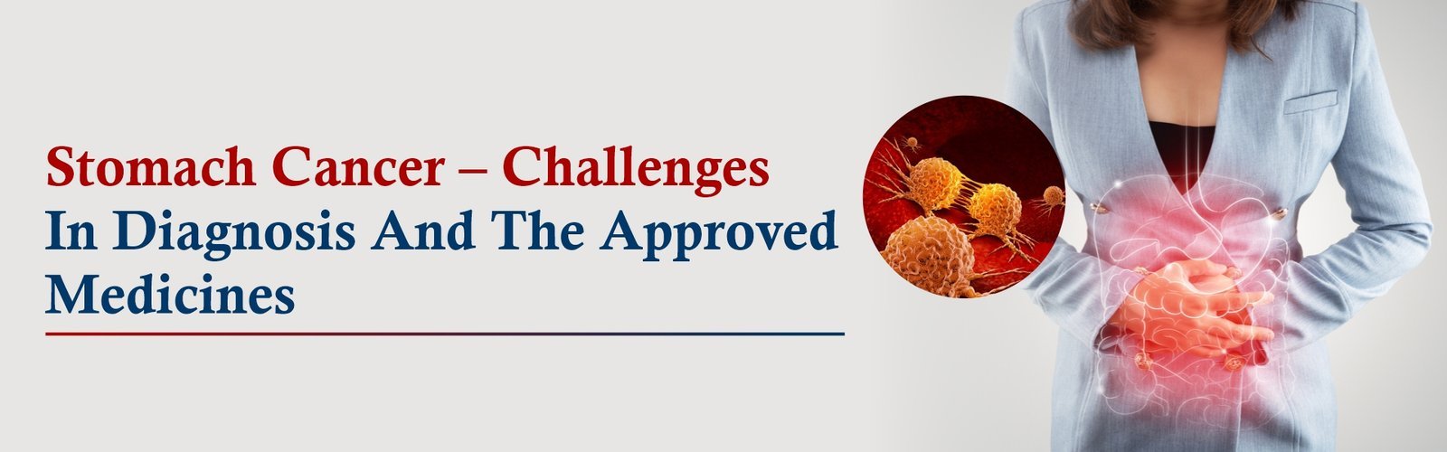 Stomach Cancer – Challenges in Diagnosis and the Approved Medicines